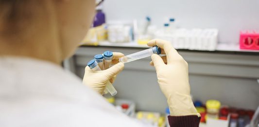 Kod još četiri osobe iz Bora otkriven COVID-19, koronavirus potvrđen kod ukupno 73 Borana