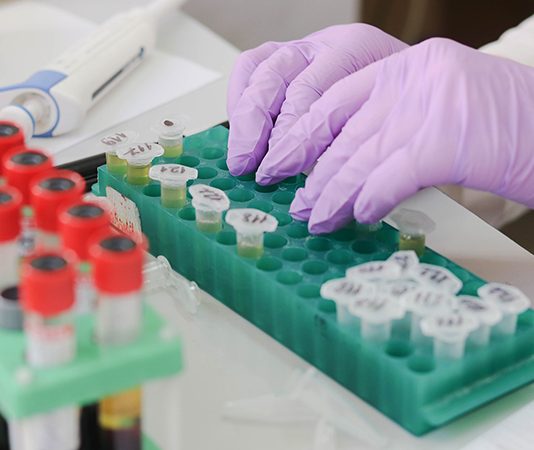 Potvrđen još jedan slučaj koronavirusa u Srbiji, peti po redu