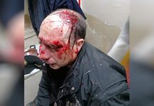 Brutalno pretučen radnik Ineks Plusa